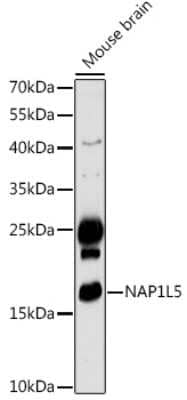 Western Blot: NAP1L5 Antibody [NBP2-94432] - Western blot analysis of extracts of Mouse brain, using NAP1L5 antibody (NBP2-94432) at 1:1000 dilution. Secondary antibody: HRP Goat Anti-Rabbit IgG (H+L) at 1:10000 dilution. Lysates/proteins: 25ug per lane. Blocking buffer: 3% nonfat dry milk in TBST. Detection: ECL Basic Kit. Exposure time: 180s.